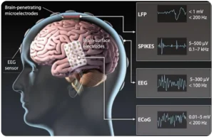 Brain-Computer Interfaces