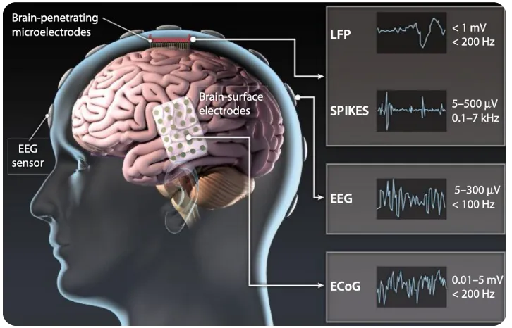 Brain-Computer Interfaces